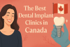 The Best Dental Implant Clinics in Canada bikrisohoj